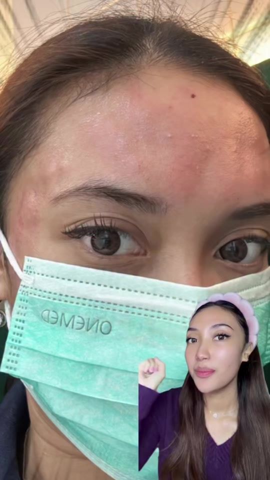 TikTok video thumbnail by inidivyy