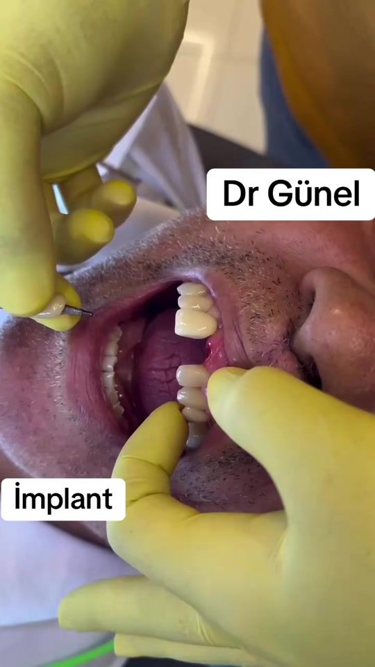 TikTok video thumbnail by dentist_gunel