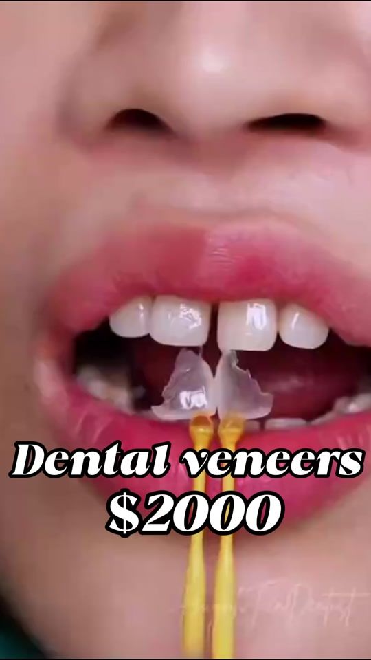 TikTok video thumbnail by 689tooth