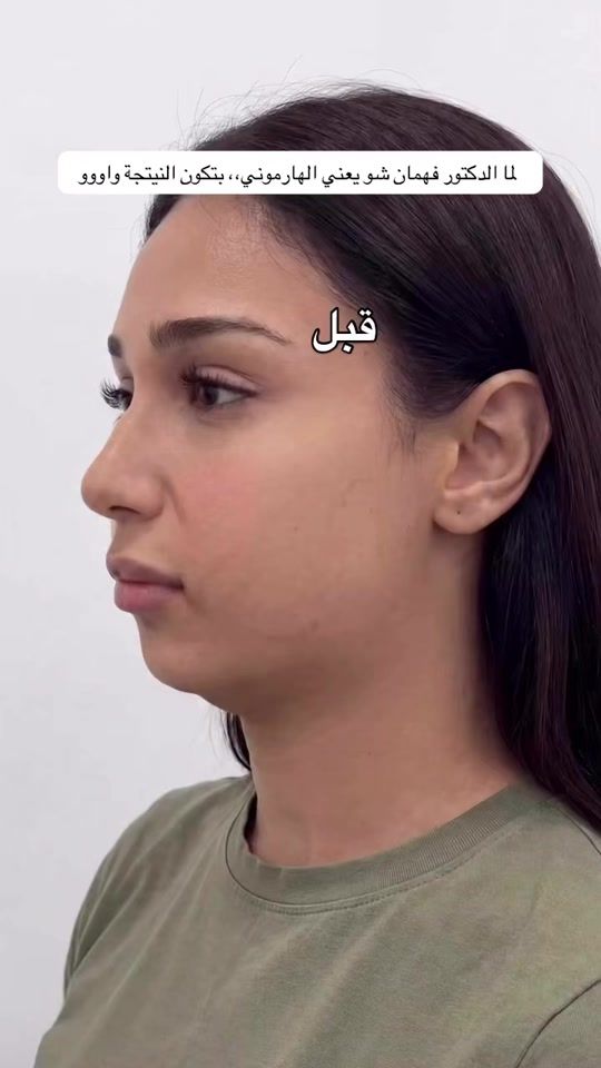 TikTok video thumbnail by doctor.yousef