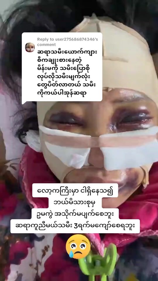 TikTok video thumbnail by htunmyat.46