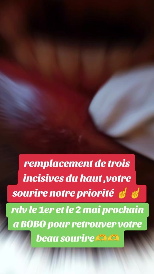 TikTok video thumbnail by lpdurielle