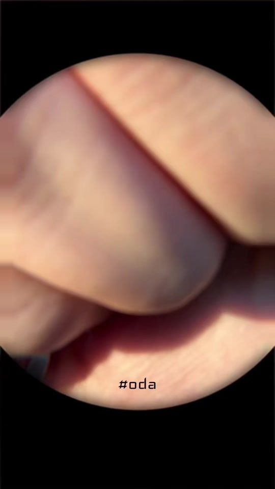TikTok video thumbnail by farizilyass