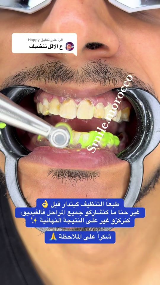 TikTok video thumbnail by smile.morocco4