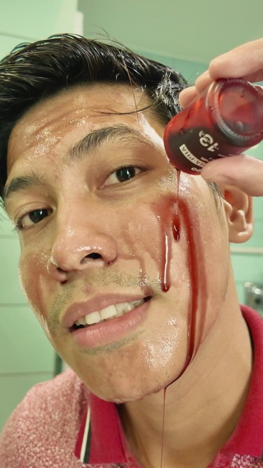 TikTok video thumbnail by dr.leo.philippines