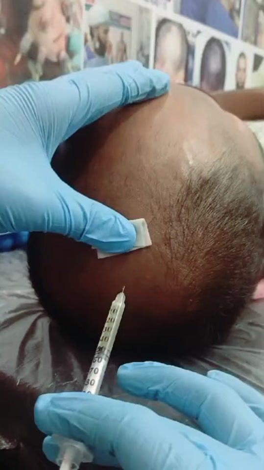 TikTok video thumbnail by dr.abdullahabid