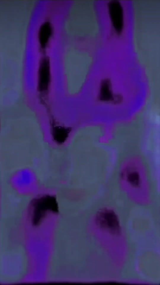 TikTok video thumbnail by 4ntoffx