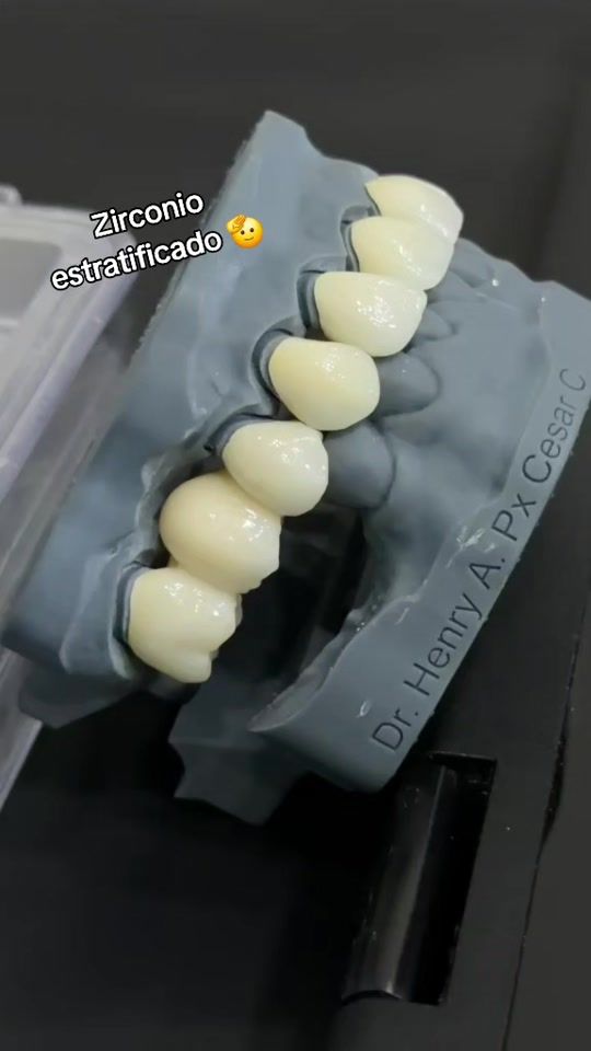 TikTok video thumbnail by alegriaclinica