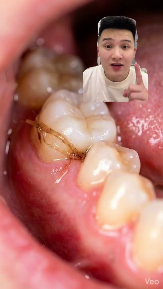 TikTok video thumbnail by lee.bitu