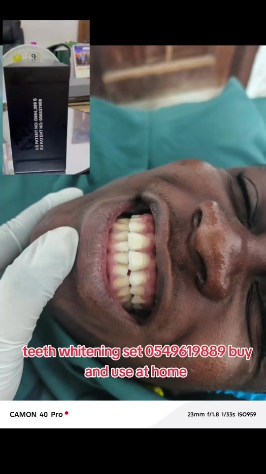 TikTok video thumbnail by dr.nao1