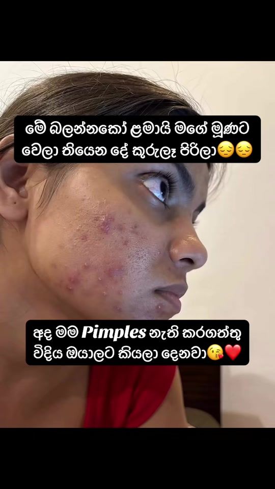 TikTok video thumbnail by ayurakanti_cream