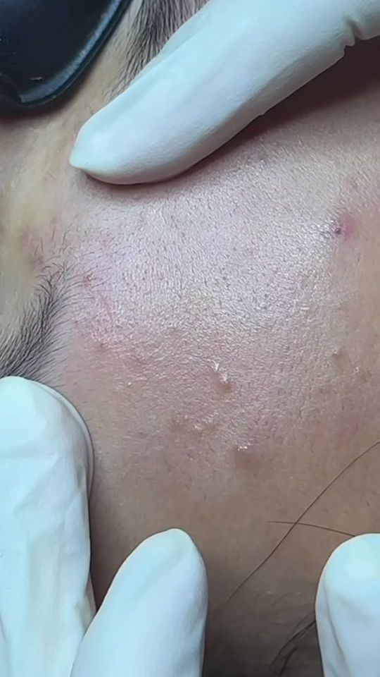 TikTok video thumbnail by nguyenchuyenmun
