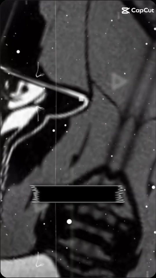 TikTok video thumbnail by h.hm951