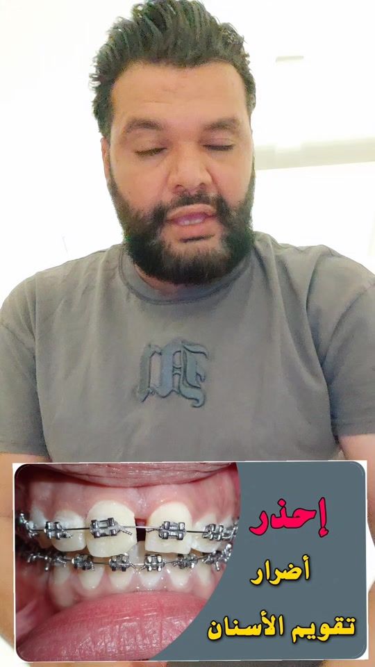 TikTok video thumbnail by dr.osamabaroud