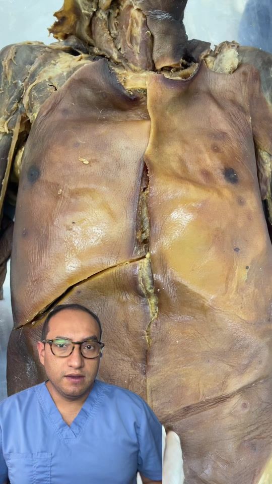 TikTok video thumbnail by dr.giogalindo