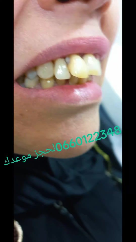 TikTok video thumbnail by uservz0srcxr6c