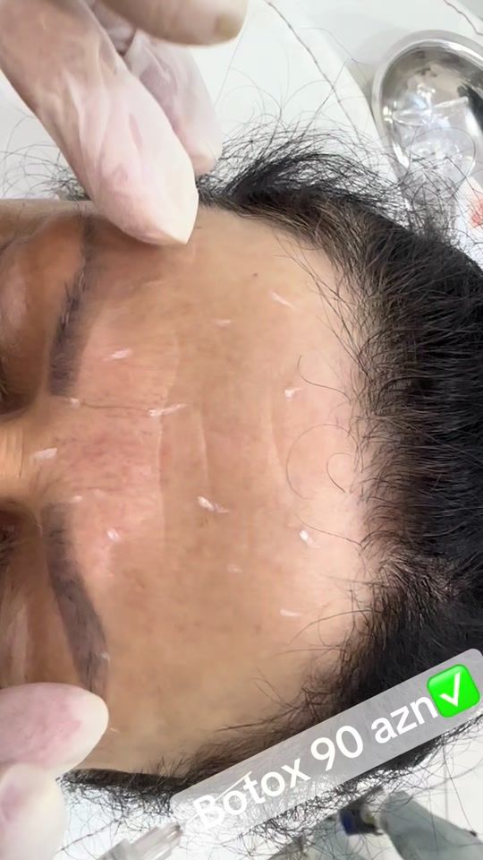 TikTok video thumbnail by dr_irade