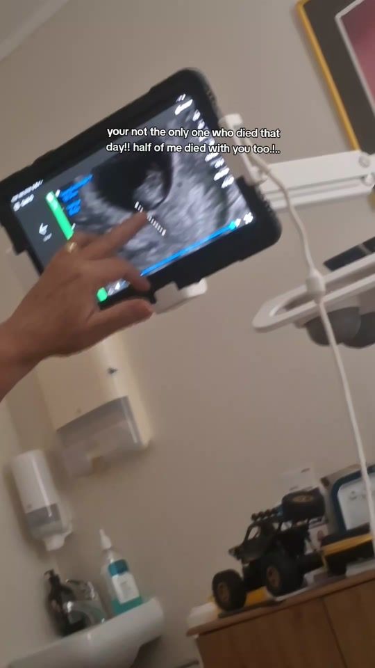 TikTok video thumbnail by quinnzmum