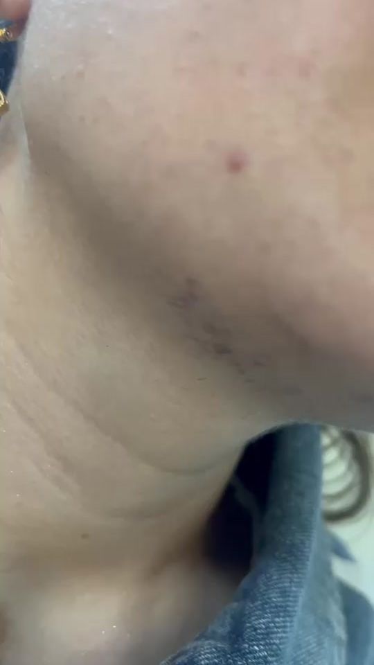 TikTok video thumbnail by doktor6878