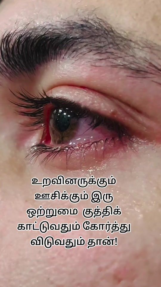 TikTok video thumbnail by _black_heart_72
