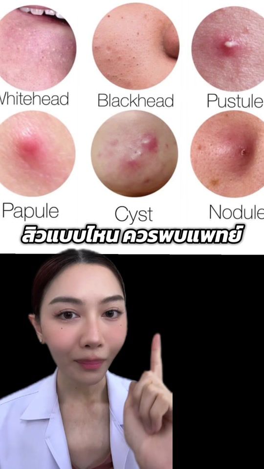 TikTok video thumbnail by ggarfield.p