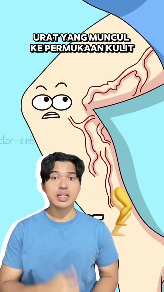 TikTok video thumbnail by ekidarehanf
