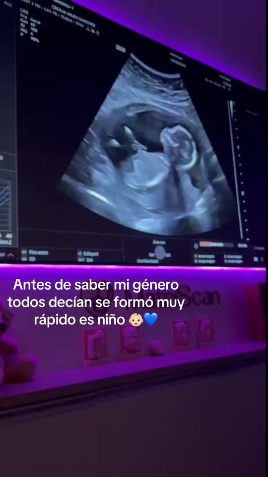 TikTok video thumbnail by ailensanchezz