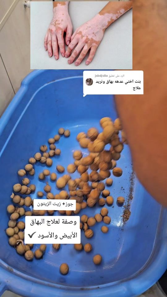 TikTok video thumbnail by jehad1001