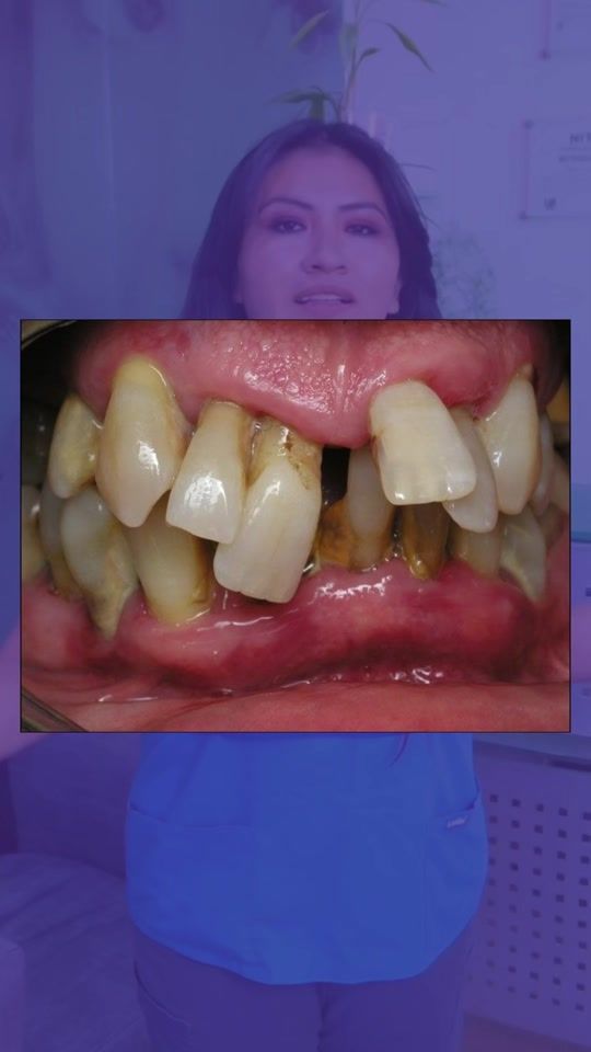 TikTok video thumbnail by drapaodentista