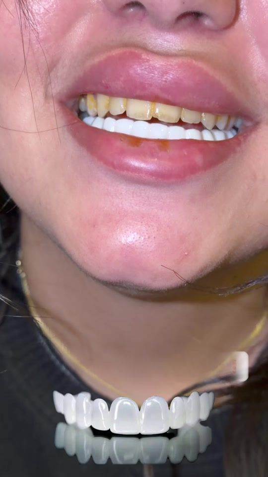 TikTok video thumbnail by dr.muhammad.mostafa