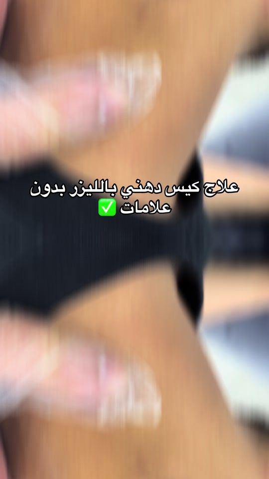 TikTok video thumbnail by dr.islamhani