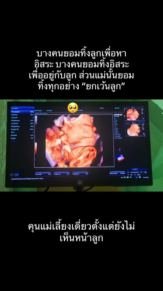 TikTok video thumbnail by singlemom202511