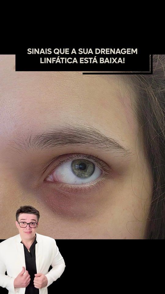 TikTok video thumbnail by drandremarinho