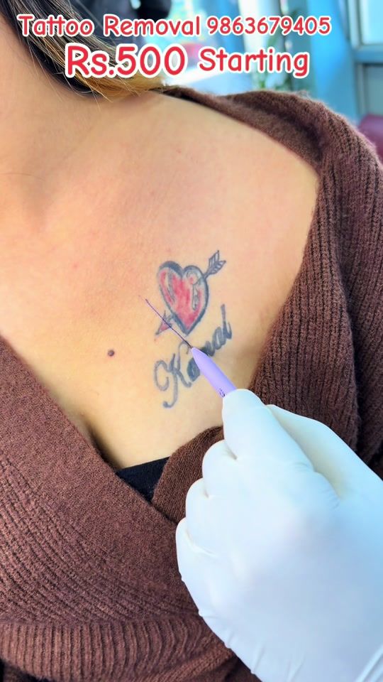 TikTok video thumbnail by drtattoo0