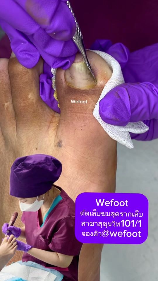 TikTok video thumbnail by wefoot8