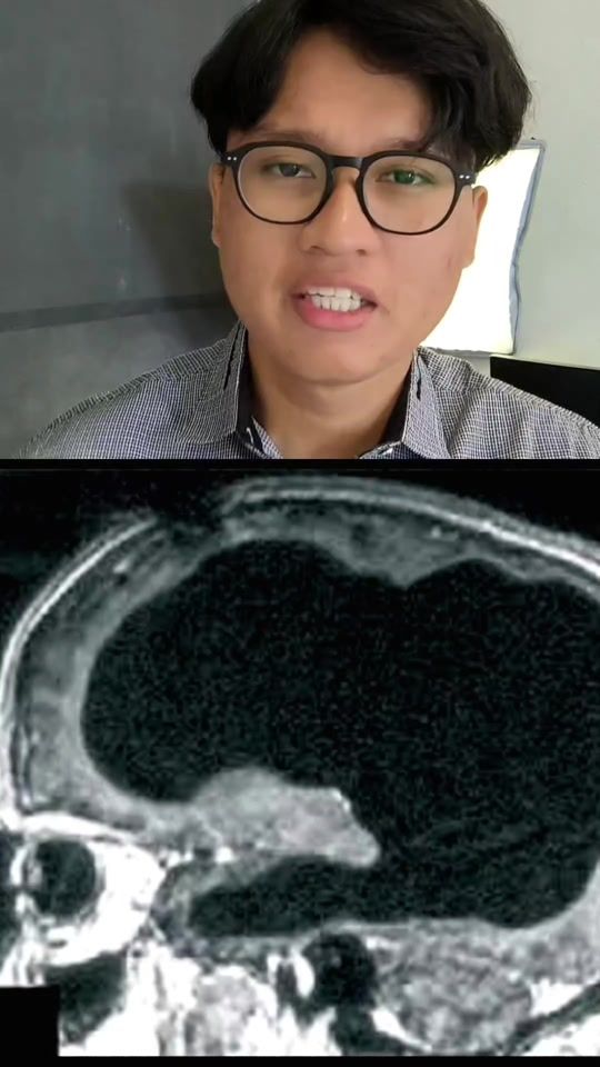 TikTok video thumbnail by virgaraditya