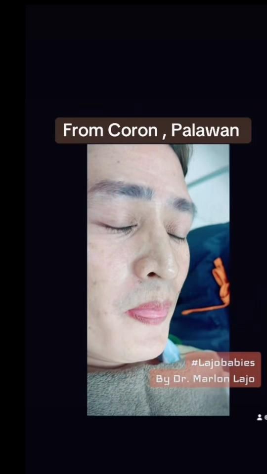 TikTok video thumbnail by lajo_md