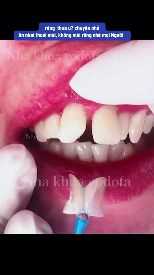 TikTok video thumbnail by nhakhoa_codofa