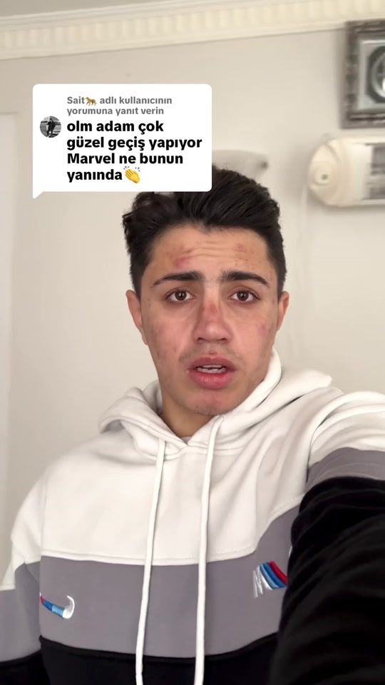 TikTok video thumbnail by 63msa