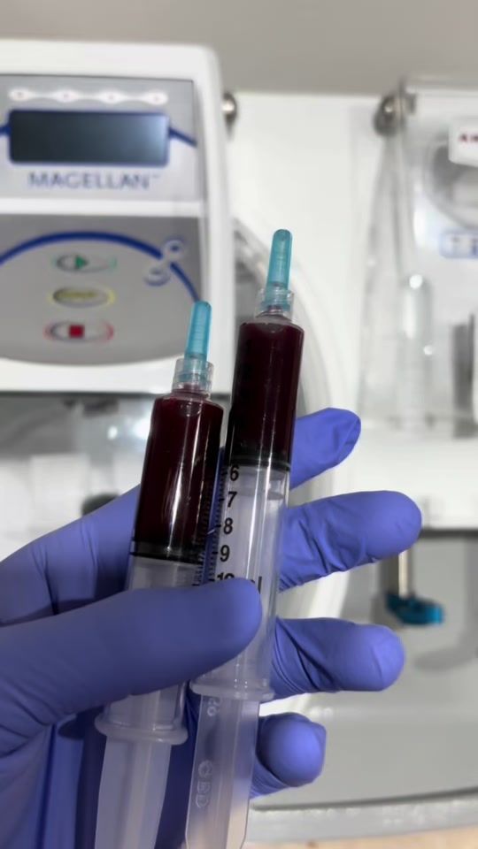 TikTok video thumbnail by doktermedok