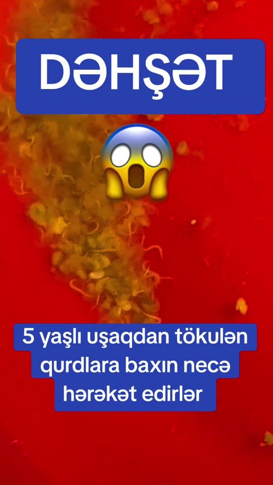 TikTok video thumbnail by eliyevaa.122