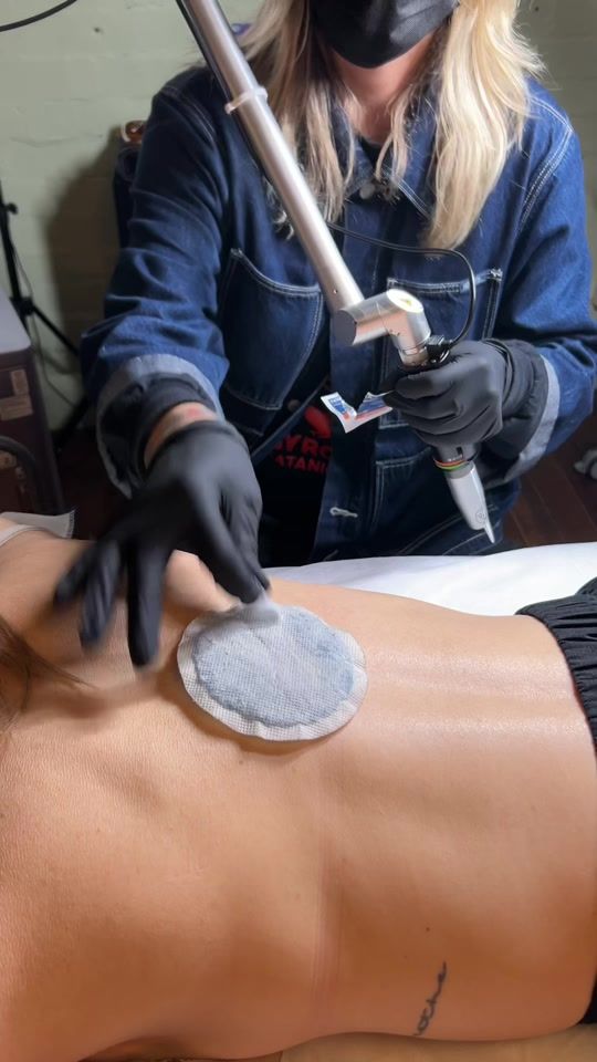 TikTok video thumbnail by swift_tattoo_removal