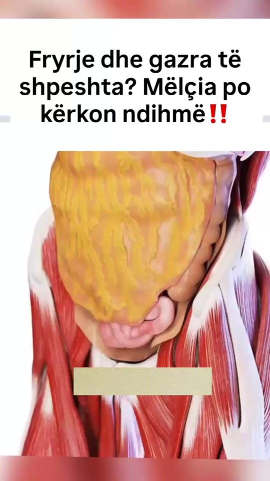 TikTok video thumbnail by adenaa.al