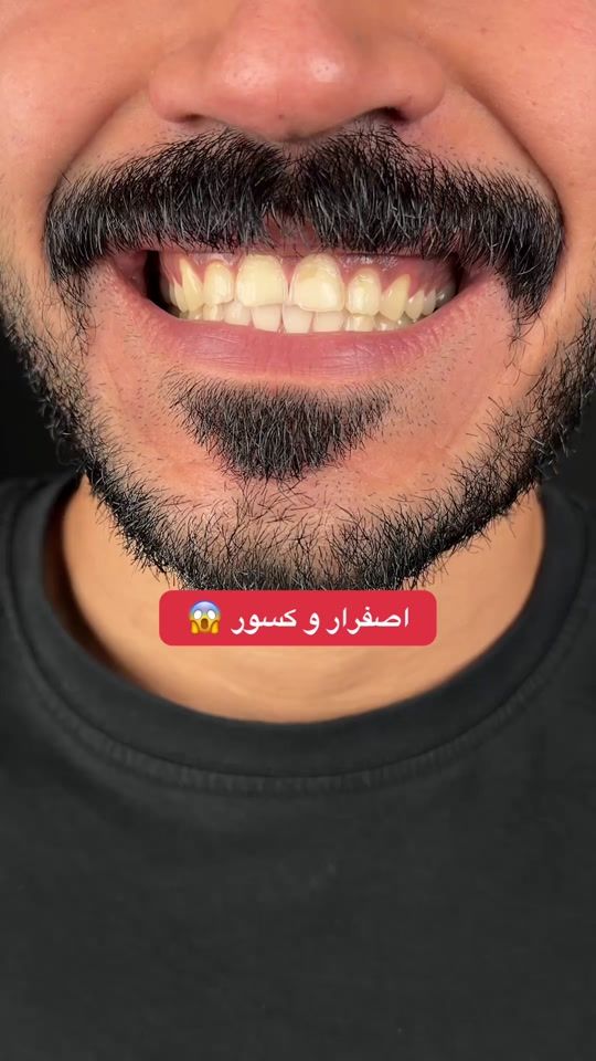 TikTok video thumbnail by albaclinics