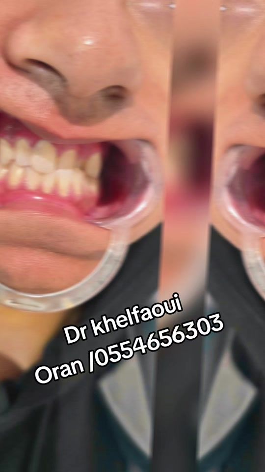 TikTok video thumbnail by uservz0srcxr6c