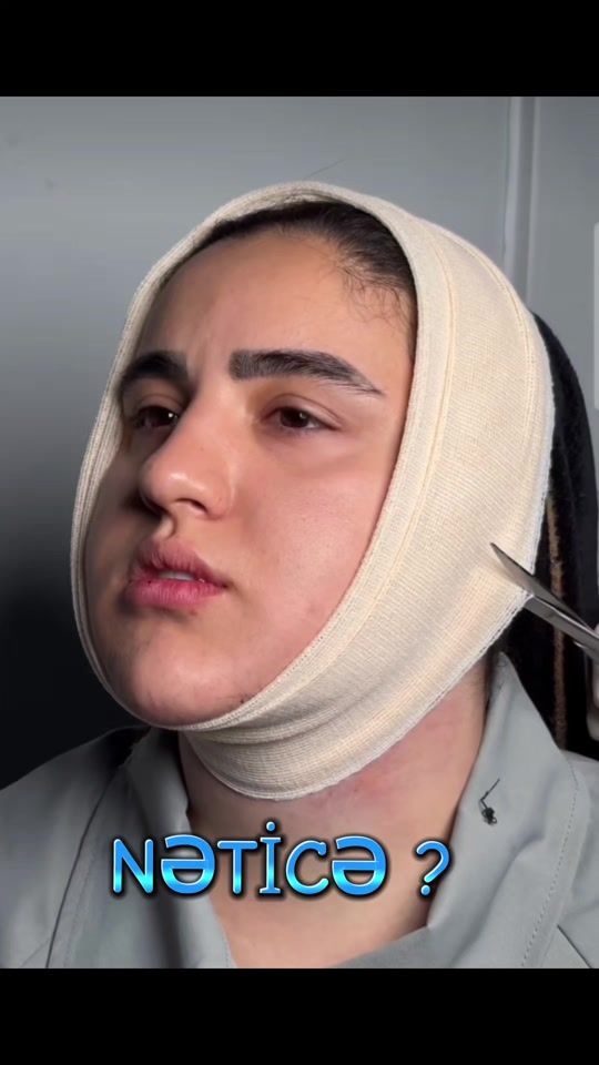 TikTok video thumbnail by uzman.doktorlar