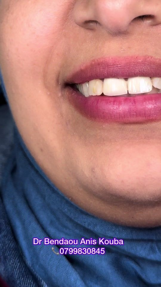 TikTok video thumbnail by dr.ben_anis
