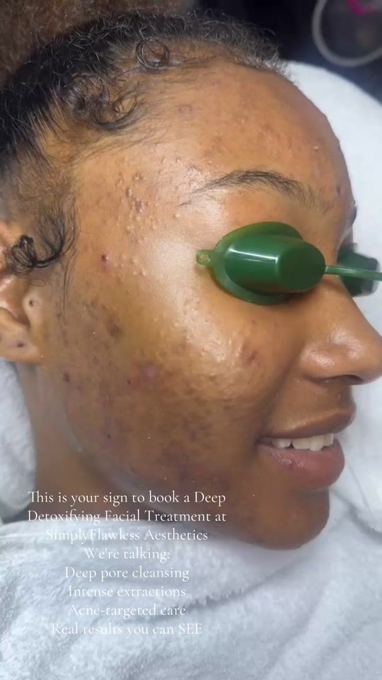 TikTok video thumbnail by arethamullings