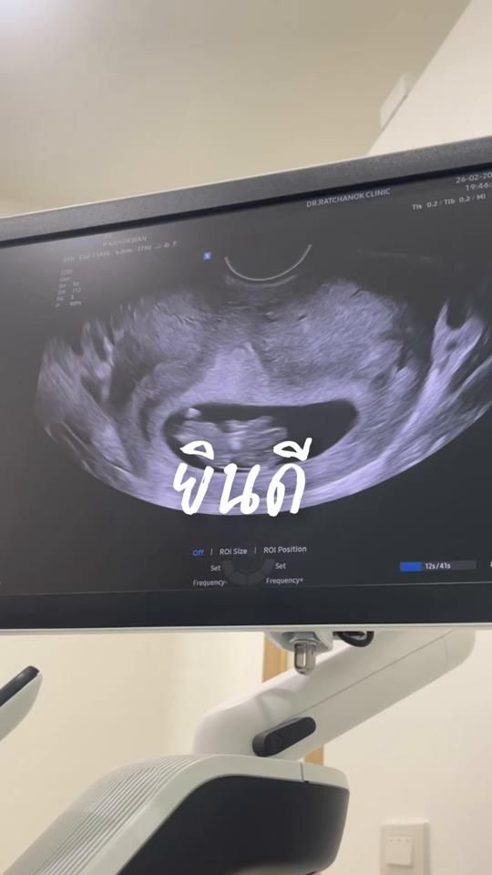 TikTok video thumbnail by sobenz_02