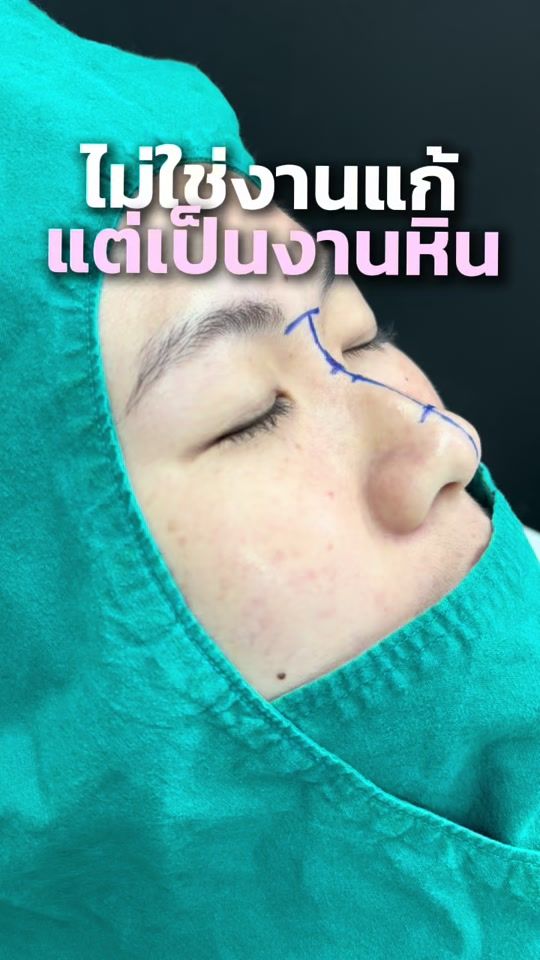 TikTok video thumbnail by lelux_surgery